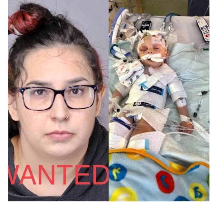 2-year-old Child Fighting For Life After Being Mercilessly Beaten By Mother’s Friend Who Was Babysitting Him.